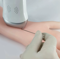 Modelo de estenosis de fístula arteriovenosa guiado por ultrasonido - Membrana de estoma para entrenamiento de dilatación con balón de anastomosis PTA en modo B