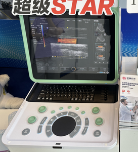Prezzi accessibili ospedale medico 3D/4D sistema di Imaging portatile portatile a colori Doppler ultrasuoni - Product Image 4