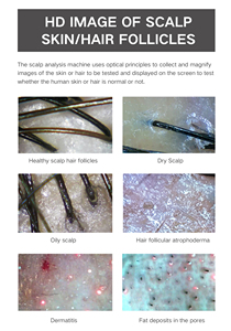 เครื่องตรวจจับหนังศีรษะแบบ Wifi เครื่องตรวจจับรูขุมขนและผิวหนังศีรษะ - Product Image 6