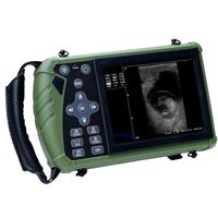 Instruments à ultrasons médicaux scanner de grossesse vétérinaire portable équipement à ultrasons