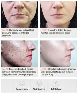 Suero Facial de etiqueta privada para humectar, blanquear y nutre la piel dañada, reduce el ácido salicólico común, Corea - Product Image 5