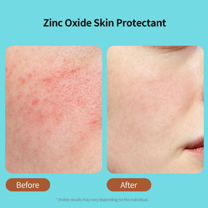 <span class=keywords><strong>Crema</strong></span> <span class=keywords><strong>Viso</strong></span> Personalizzata all'Ossido di Zinco <span class=keywords><strong>per</strong></span> Riparazione Acne, Mantenimento della Barriera Cutanea, Idratante, Non Comedogena, Cura del <span class=keywords><strong>Viso</strong></span> - Product Image 2
