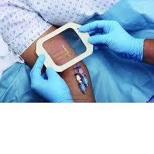 Transparent <b>Film</b> Dressing 1622W 1624W IV Cannula Fixation - Product Image 3