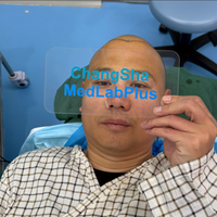 Machine de greffe capillaire FUE à micromoteur, pour implantation capillaire et punch de biopsie capillaire