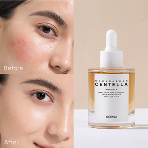 Suero Facial en Ampolla con Extracto de Centella Asiática de Marca Privada OEM para Aliviar la Inflamación de la Piel y Antioxidante - Product Image 1