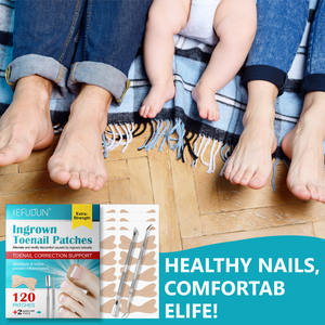 Parches para el Tratamiento de Uñas Encarnadas SEFUDUN al por Mayor, Kit de 120 Tiras Correctoras para Uñas Encarnadas con Lima y Levantador - Product Image 6