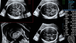 Nuevo Modelo en Oferta, Ecógrafo Veterinario con Carro <span class=keywords><strong>Mindray</strong></span> <span class=keywords><strong>DC</strong></span>-<span class=keywords><strong>70</strong></span> Exp con Imágenes Superiores X-Insight y Sondas de Cristal Único - Product Image 5