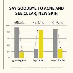 เซรั่มบำรุงผิว<span class=keywords><strong>หน้า</strong></span>อะโลเวร่าขั้นสูง: <span class=keywords><strong>รักษา</strong></span><span class=keywords><strong>สิว</strong></span>และริ้วรอย ช่วยกระตุ้นการไหลเวียนของน้ำในรูขุมขน ปรับสีผิวให้สม่ำเสมอ ปราศจากน้ำมัน สูตรต่อต้านริ้วรอยและเพิ่มความกระจ่างใส - Product Image 4