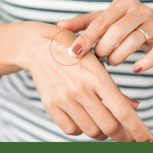 Crema de 30g para uso externo, suaviza y cicatriza las cicatrices con ingredientes de manzanilla para las estrías - Product Image 2