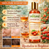 Minyak Rosehip Anti Penuaan Mencerahkan Kulit Memperbaiki Kulit Alami Minyak Rosehip Cold Pressed untuk Serum Wajah Minyak Tubuh Penggunaan Kosmetik OEM