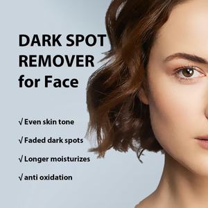 Sérum Visage Correcteur Anti-Taches Brunes, Taches de Vieillesse, Taches de Rousseur et Mélasma à la Niacinamide pour un Éclat Naturel - Product Image 6