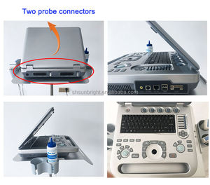 Mesin Ultrasonografi Doppler Medis Portabel <span class=keywords><strong>2</strong></span> Probe Portabel 3D 4D Doppler Warna - Product Image 5