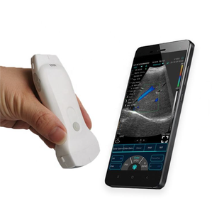 Vente directe d'usine, sonde d'échographie vétérinaire portable multifonctionnelle, utilisation animale, échographie de la tête, sans fil, VENTE CHAUDE - Product Image 1