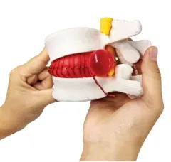 A1015-1 ADA thương hiệu vật liệu PVC thoát vị intervertbral đĩa mô hình cho y tế khoa học trường giảng dạy - Product Image 3