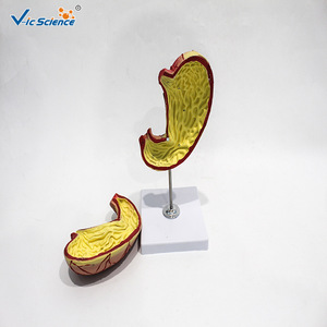 Modèle d'inflammation gastrique, modèle d'anatomie pathologique, aides pédagogiques et de formation médicales pour les lésions d'inflammation gastrique. - Product Image 2