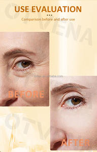 Suero Reafirmante para Ojos OTVENA, Fórmula Recién Mejorada, Suero Dual para Ojos Reafirmante y Radiante - Product Image 3