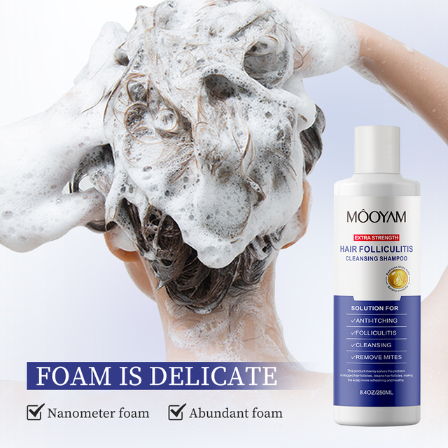 Refreshingly Nourishing Cream Shampoo for Folliculitis Scalp Psoriasis Seborrheic Herbal Liquid Conditioner Moisturizing