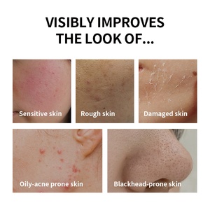 <span class=keywords><strong>โฟม</strong></span><span class=keywords><strong>ล้าง</strong></span><span class=keywords><strong>หน้า</strong></span>สูตรอ่อนโยนสำหรับผิวเป็นสิว ด้วยสารสกัดจากกรดอะซิแอติกและใบบัวบก ช่วยควบคุมความมัน ลดสิว ผิวกระจ่างใส ทำความสะอาดล้ำลึก และเติมความชุ่มชื้น - Product Image 5