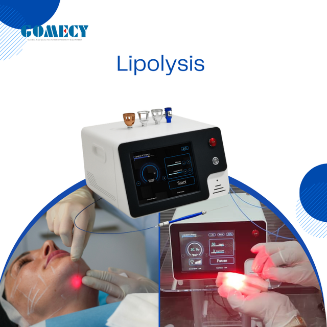 1470nm 980nm 635nm Triple Wavelength Diode Laser for Subdermal Skin Tightening Internal Lipolysis and Vascular Therapy