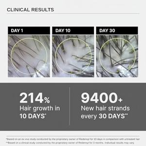 Сыворотка для роста волос, 3% розмарин, 2% аминоксил, 3% реденсил, 2%, чистый растительный экстракт и без сульфатов | Без масла - Product Image 4
