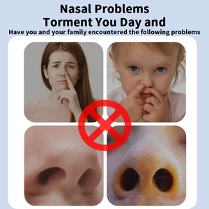 Tiras <span class=keywords><strong>Nasales</strong></span> para Corrección de Nariz, Contorno Elástico, Parche de <span class=keywords><strong>Alas</strong></span> <span class=keywords><strong>Nasales</strong></span> con Forma de Mancuerna Pequeña, Adhesivo para <span class=keywords><strong>Alas</strong></span> <span class=keywords><strong>Nasales</strong></span> con Forma de Mancuerna, Nuevo y Más Vendido - Product Image 2