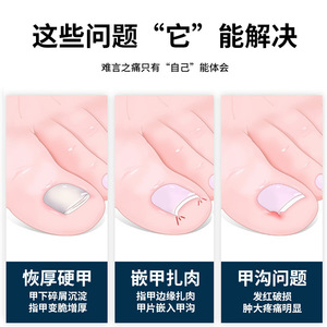 Nail clippers for ingrown toenails, toenail clippers, onychomycosis clippers, pointed tip pedicure nail clippers set. - Product Image 4