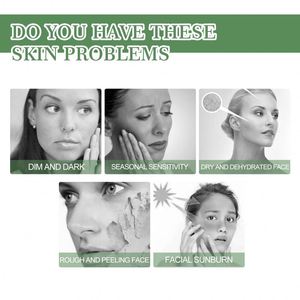 ครีมบำรุงผิวหน้า EELHOE 50 มล. ครีมกันแดดกลางวัน ปกป้อง<span class=keywords><strong>ผิว</strong></span> ช่วยให้ผิวชุ่มชื้น กระชับ กระจ่างใส ลดรอยไหม้แดด <span class=keywords><strong>ผิว</strong></span>หยาบกร้าน <span class=keywords><strong>ลอก</strong></span>เป็นขุย สำหรับใช้ที่บ้าน - Product Image 6