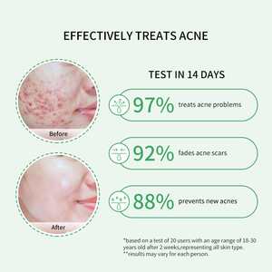 Suero de Ácido Salicílico con Centella y Extracto Mineral de Ceramida, Líquido Hidratante para el Cuidado Facial de la Piel - Product Image 4