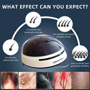 Gorro con Luces Láser LLLT para el Tratamiento de la Caída del Cabello, Dispositivos para el Crecimiento del Cabello, <span class=keywords><strong>Casco</strong></span> Láser para el Crecimiento del Cabello, <span class=keywords><strong>Casco</strong></span> de Terapia de Luz Infrarroja - Product Image 2