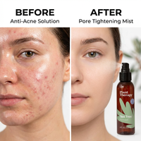 Hydrolat sans alcool personnalisé, brume rafraîchissante pour le visage, eau florale distillée naturelle pour tous types de peau, hydrolat d'arbre à thé