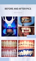 Lampe de blanchiment des dents 60W, 3 à 5 jours, 12 pièces, lumières bleues LED, stock de machine de blanchiment des dents