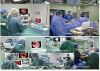 Ensemble d'endoscopes vétérinaires SY-PS050 pour laparoscopie, cystoscopie et arthroscopie, caméra endoscopique portable Full HD 1080P pour chirurgie et diagnostic