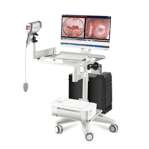 Kamera medis Digital HD Video Vagina elektrik colposkop pemeriksaan berlogika untuk ginekologi Vagina endoskopi dibuat logam - Product Image 5