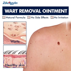 ZouRunAn Skin Herbal Extract <strong>Genital</strong> <strong>Warts</strong> Removal Ointment <strong>Genital</strong> <strong>Wart</strong> Relief Cream 6 Months Shelf Life - Product Image 2