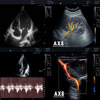 Escáner de Ultrasonido Doppler a Color Portátil para Veterinaria con Sondas Convexas y Lineales para Detección de Embarazo