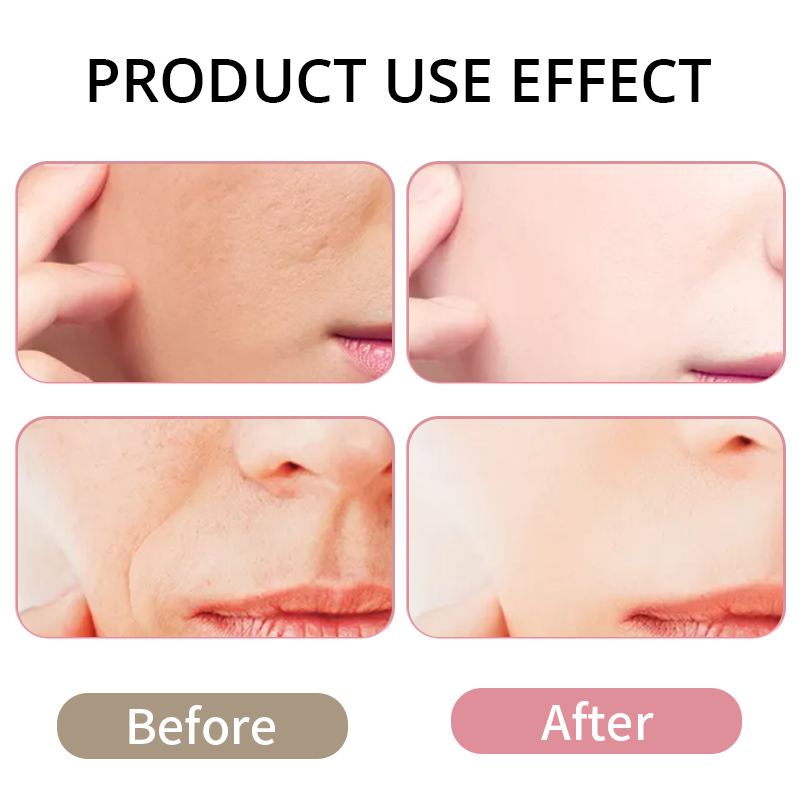 skin care set free shipping