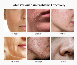 Cosmetici coreani all'ingrosso bellezza <span class=keywords><strong>naturale</strong></span> per la cura della pelle miele idratante organico maschera per il viso etichetta privata maschere per il viso bellezza - Product Image 6