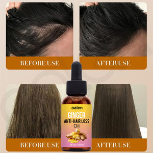 Aceite de Tratamiento Capilar de Jengibre Luxfume, Natural, Anticaída, Previene la Calvicie, Crecimiento Rápido, Nutritivo para Cabello Seco y Dañado - Product Image 4