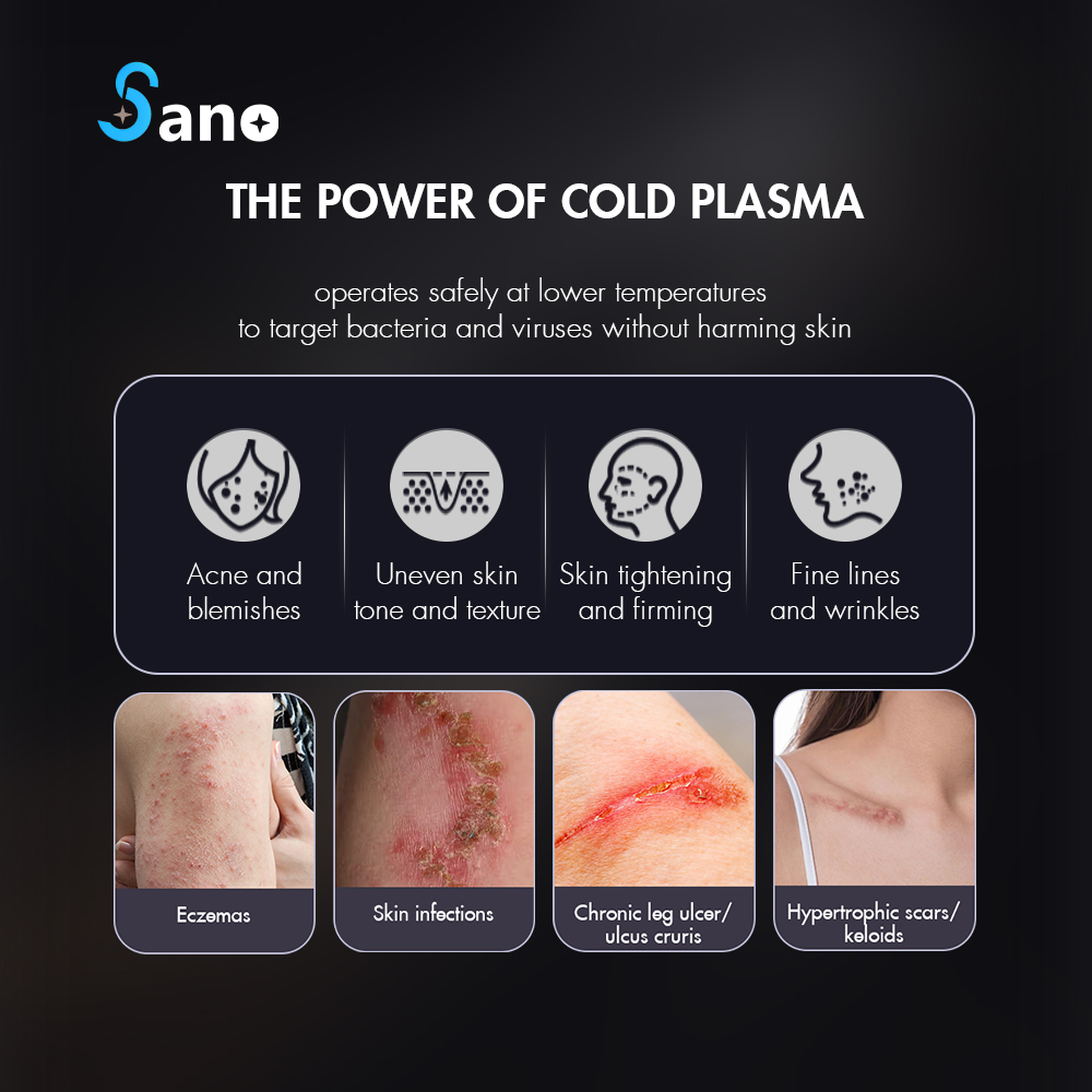 jet cold plasma