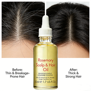 Rosmarin-Haarpflege Ätherisches Öl zur Nährung der Kopfhaut, Reparatur von Geschädigtem Haar und Stärkung der Haarwurzeln - Product Image 5