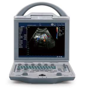<span class=keywords><strong>Centro</strong></span> <span class=keywords><strong>de</strong></span> imágenes <span class=keywords><strong>de</strong></span> diagnóstico médico por ultrasonido veterinario con escáner <span class=keywords><strong>de</strong></span> Cardiología máquina <span class=keywords><strong>de</strong></span> ultrasonido portátil - Product Image 3