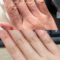 Outil de beauté intelligent pour les mains et les pieds, capsule spatiale, lumière rouge et bleue, vapeur, blanchiment, régénération du collagène, compatible