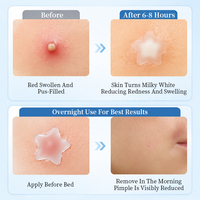 Patchs autocollants anti-acné 48 étoiles les plus vendus pour couvrir les boutons et les marques d'acné sur le visage, portables pour le voyage