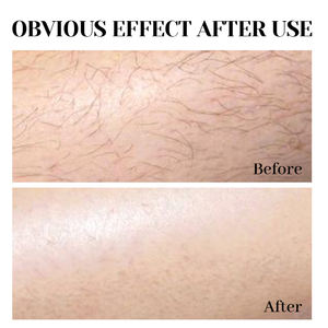 สารยับยั้ง<span class=keywords><strong>ก</strong></span>ารเจริญเติบโตของเส้นผม30มล. ที่ปรับปรุงแล้วไม่ระคายเคือง<span class=keywords><strong>ก</strong></span>าร<span class=keywords><strong>ก</strong></span>ำจัดสำหรับร่าง<span class=keywords><strong>ก</strong></span>ายใบหน้าแขนรักแร้ขาสำหรับผู้ชายและผู้หญิง - Product Image 6