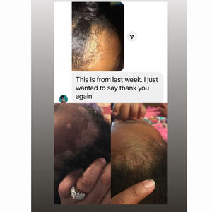 Shampoo <span class=keywords><strong>anti</strong></span>-<span class=keywords><strong>poux</strong></span>, traitement contre les <span class=keywords><strong>poux</strong></span>, défense quotidienne sans pesticide, shampooing <span class=keywords><strong>anti</strong></span>-<span class=keywords><strong>poux</strong></span> - Product Image 5