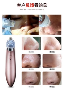 Equipo Antienvejecimiento de Primera Calidad, Limpiador Facial de Poros, Eliminador de Puntos Negros con Masajeador Facial - Product Image 3