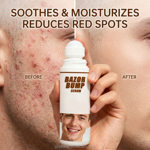 Sérum Apaisant Post-Rasage Anti-Poils Incarnés Marque Blanche pour les Points Rouges et la Réparation Cutanée, Roll-on 100ml - Product Image 1