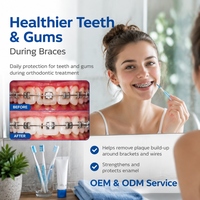Dentifrice orthodontique OEM/ODM 100ml saveur pomme-menthe avec fluorure de sodium CPC et aloe vera pour soins dentaires quotidiens destiné aux porteurs d'appareils.