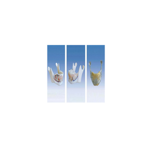 Produit anatomique de modè<span class=keywords><strong>le</strong></span> de PVC de dents d'os de mâchoire dentaire de BIX-L1027 pour la comparaison de la science médicale de l'anatomie normale <span class=keywords><strong>et</strong></span> <span class=keywords><strong>pathologique</strong></span> - Product Image 1