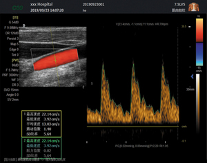 Sistema de Ultrasonido Profesional HD 3D 4D de 15 Pulgadas con Función Doppler PW CW para Aplicaciones de Cardiología - Product Image 5